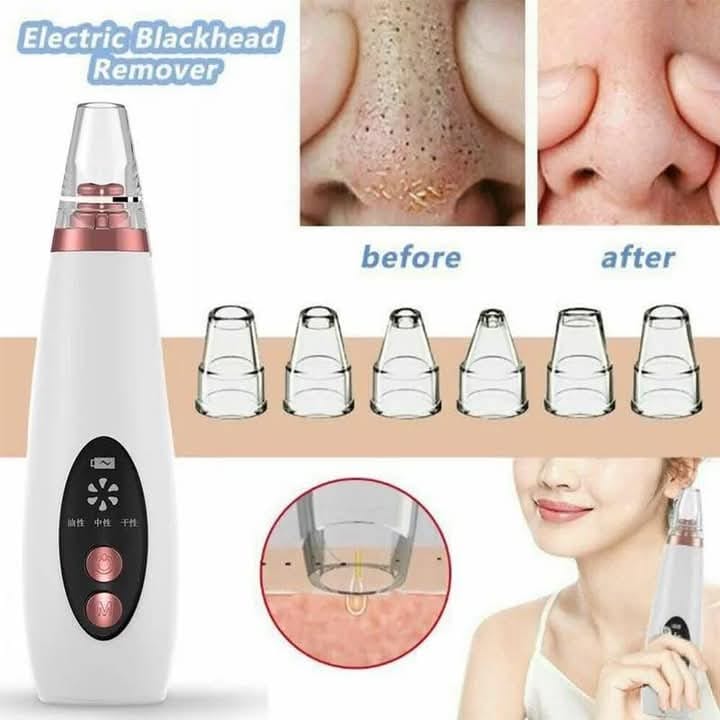 Blackhead Remover Machine